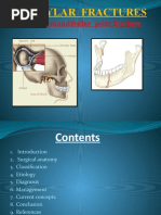 Condylar Fracture 3