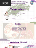 Tuberculosis