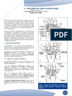 Luxación Carpo
