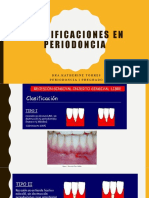 0 - Recesiones Gingivales