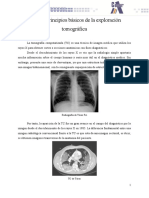 Tema 1. Principios Básicos de La Exploración Tomográfica