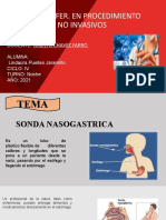 Sonda Nasogastrica