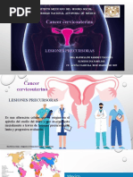 Lesiones Precursoras de CCu