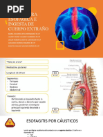 Quemadura Esofagica 1 PARTE