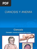 Anemia y Cianosis