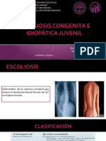 Escoliosis Idiopática Juvenil YOLANDA CARRIZALES