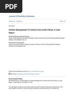 Holistic Management For Severe Oral Lichen Planus - A Case Report