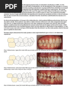 2 Classification of Malocclusion