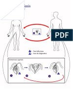 Trichomonas