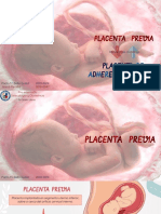 Placenta Previa y Placenta de Adherencia Mórbida