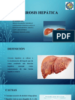 Cirrosis Hepática