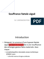 Souffrance Fœtale Aiguë Bnmokhtar 2022