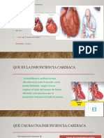 Insuficiencia Cardiaca