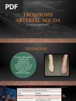 Trombosis Arterial Aguda