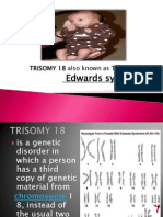 Edwards Syndrome: TRISOMY 18 Also Known As Trisomy E or