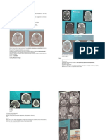 Casos Neurosara ! - Documentos Google