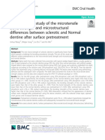 A Comparative Study of The Microtensile Bond Strength and Microstructural Differences Between Sclerotic and Normal Dentine After Surface Pretreatment