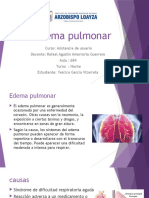 Edema Pulmonar