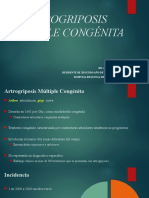 Artrogriposis Múltiple Congénita