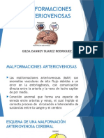 Malformaciones Arteriovenosas