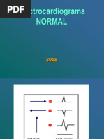 ECG Normal