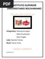 Trabajo Grupal Diverticulitis