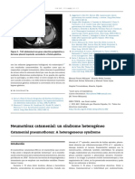 Neumoto Rax Catamenial: Un Sı Ndrome Heteroge Neo: Catamenial Pneumothorax: A Heterogeneous Syndrome