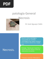 Necrosis+2021dr Aguayo