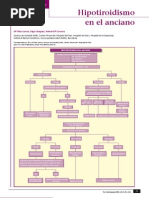 Hipotiroidismo en El Anciano