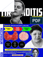 TIROIDITIS