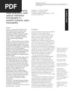 Crowded Optic Nerve Head Evaluation With Optical Coherence Tomography in Anterior Ischemic Optic Neuropathy