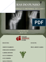 Fraturasdopunho 160607071750