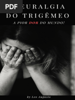 Neuralgia Do Trigêmeo