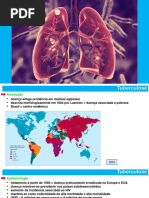 Tuberculose