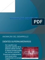 Anomalias Dentales