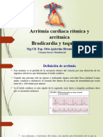 Arritmia Cardiaca Rítmica y Arrítmica