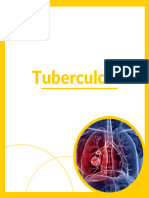 Tuberculose