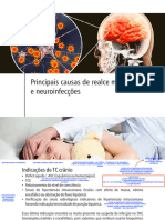 Aula 4.realce Meníngeo e Infecções SNC