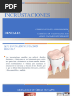 Incrustaciones