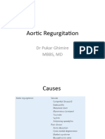 Aortic Regurgitation