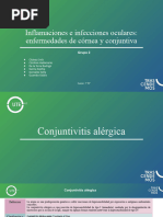 Inflamaciones e Infecciones Oculares - Enfermedades de Córnea y Conjuntiva