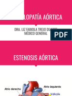 Valvulopatía Aórtica