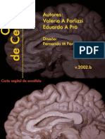 Cortes de Cerebro