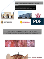 Lesiones Premalingas de Vuvla y Cancer de Vuvla