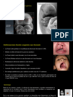 Resumen Clase 1 de Malformaciones Craneo Faciales.