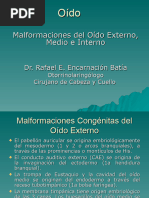 Malformaciones Congã©nitas Del Oido