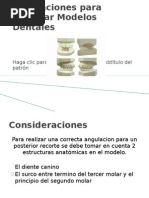 Angulaciones para Recortar Modelos Dentales