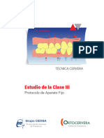 Protocolo de Aparato Fijo de Clase III Extracciones 10 Enero 2023