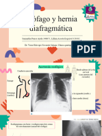 Esofago y Hernias