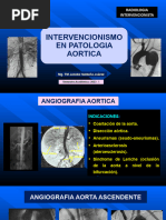 Intervencionismo en Patologia Aortica